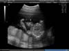 BABY_30
