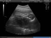BABY_33