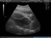 BABY_34