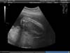 BABY_35