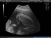 BABY_36