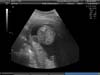 BABY_37