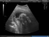 BABY_38