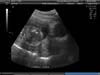 BABY_39