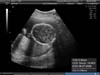 BABY_4