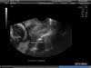 BABY_45
