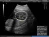 BABY_5