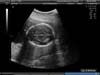 BABY_7