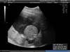 BABY_9